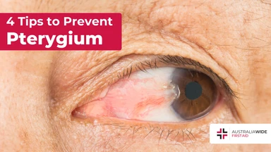 Prevent pterygium article header – First Aid Article in Deception Bay